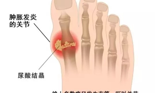 食物中毒大便会发黑吗-食物中毒大便化验结果网- 食物中毒大便化验结果图片知识,分享食物中毒后便血怎么回事